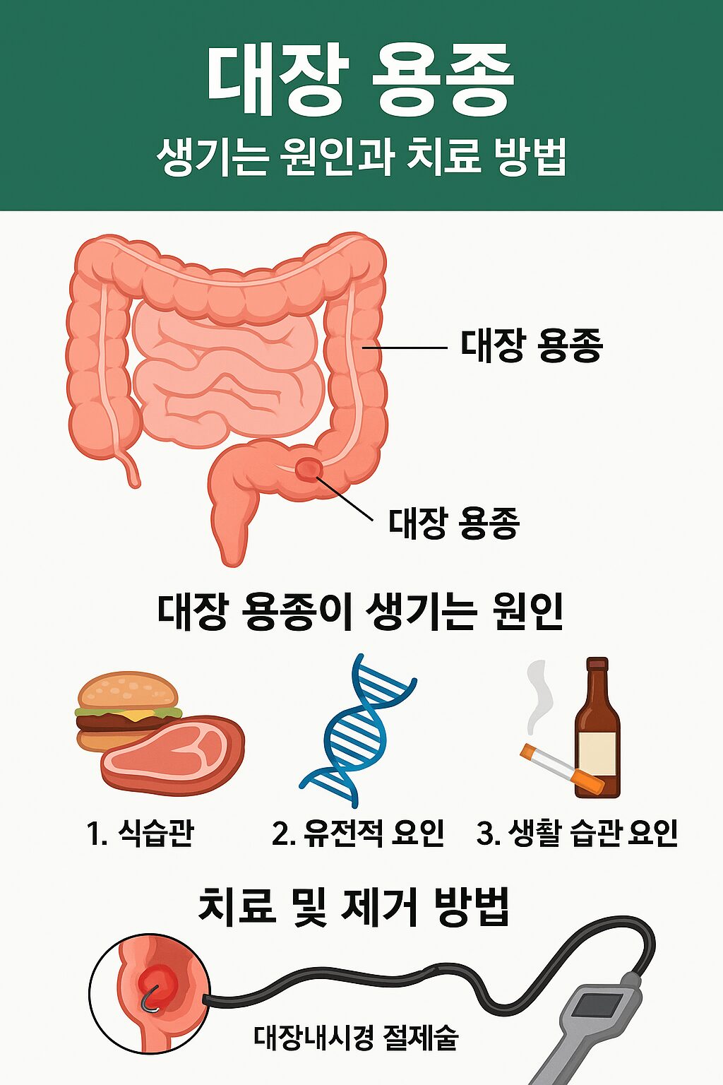 대장 용종이 생기는 원인 미라드라이