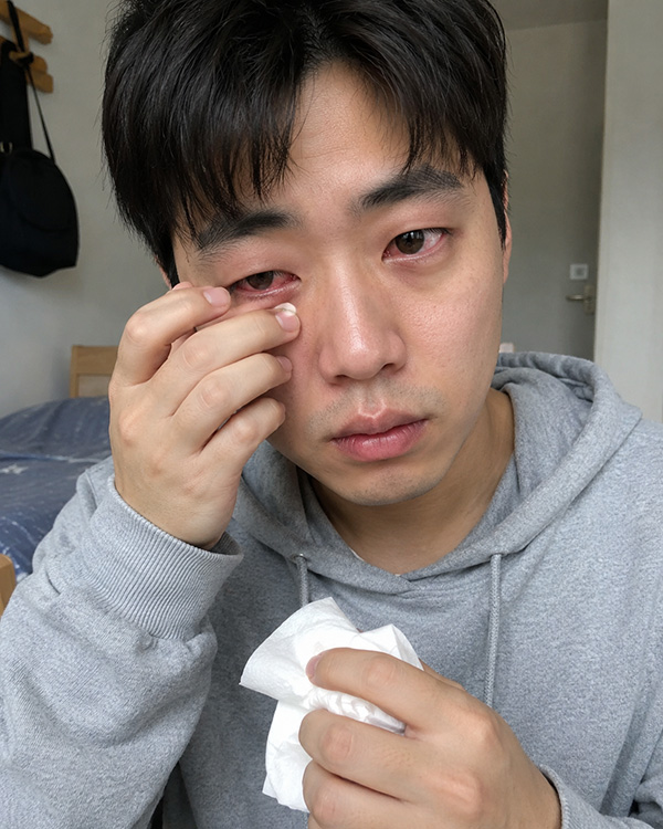 유행성결막염 왜 걸리는 것일까?